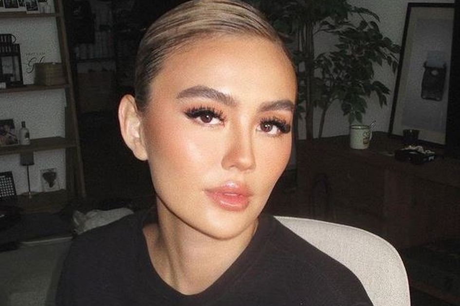 Kasus Agnez Mo